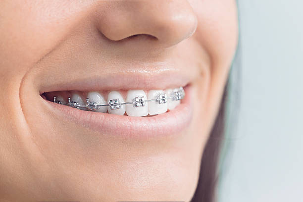 Best Veneers and Lumineers  in Mount Pulaski, IL